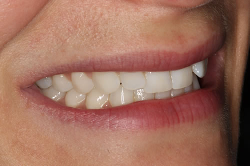 before treatment