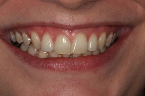 before treatment