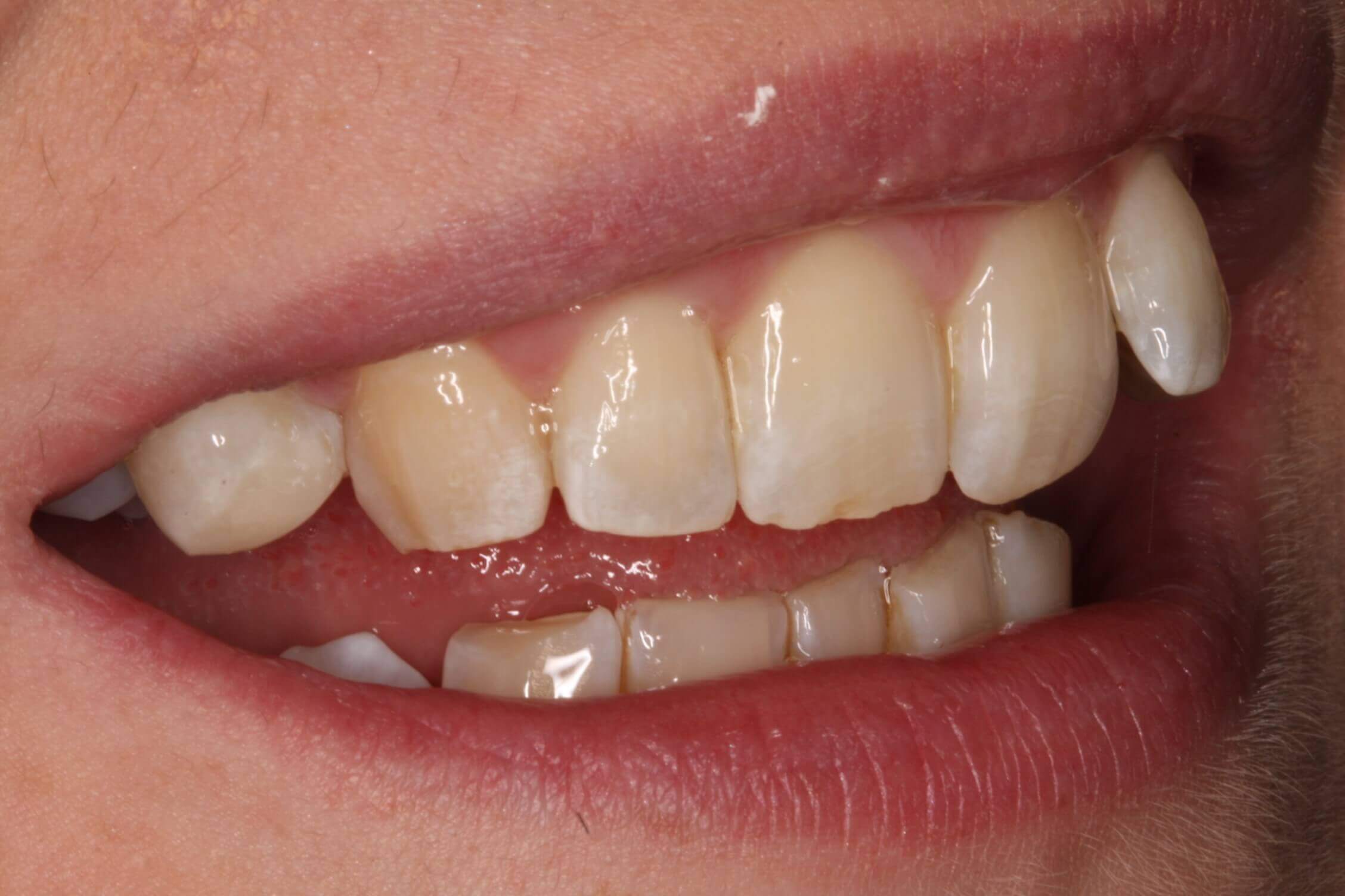 before treatment