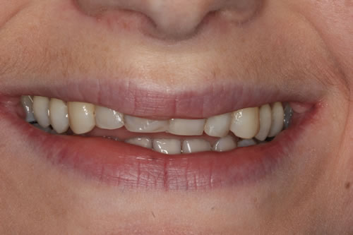 before treatment