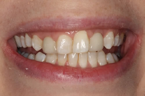 before treatment