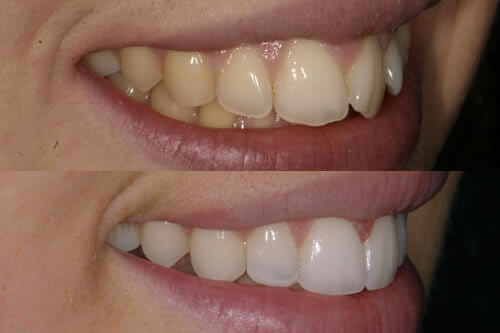 Orthodontist Navan
