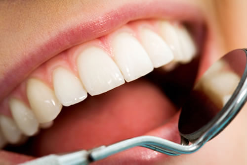 Checkups at navan Dental